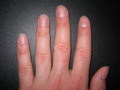 hands